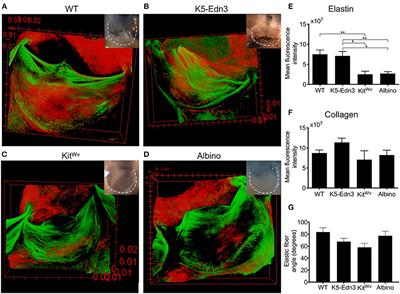 Pigmentation Affects Elastic Fiber Patterning and Biomechanical Behavior of the Murine Aortic Valve